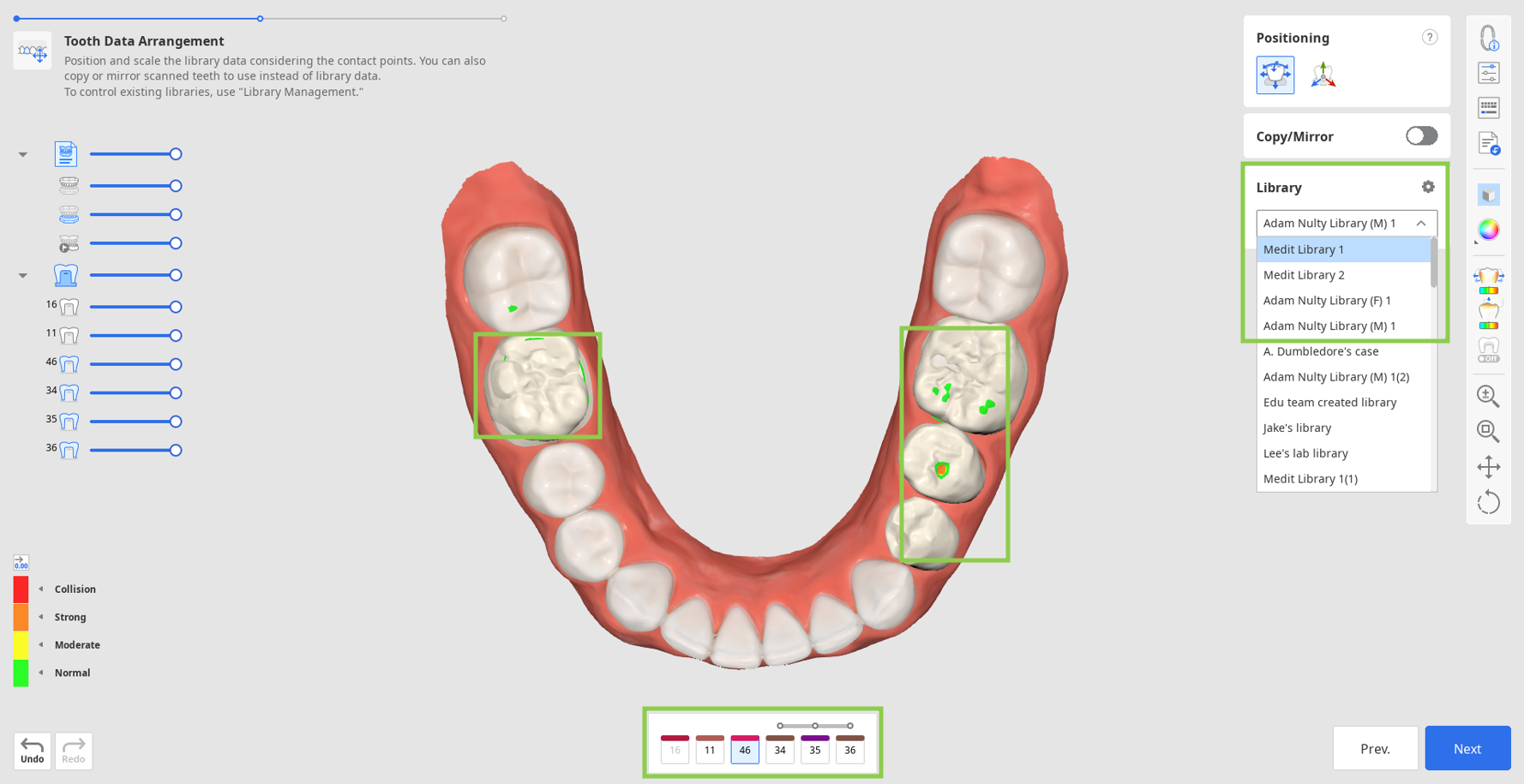 prep_tooth_data_arrangement__1