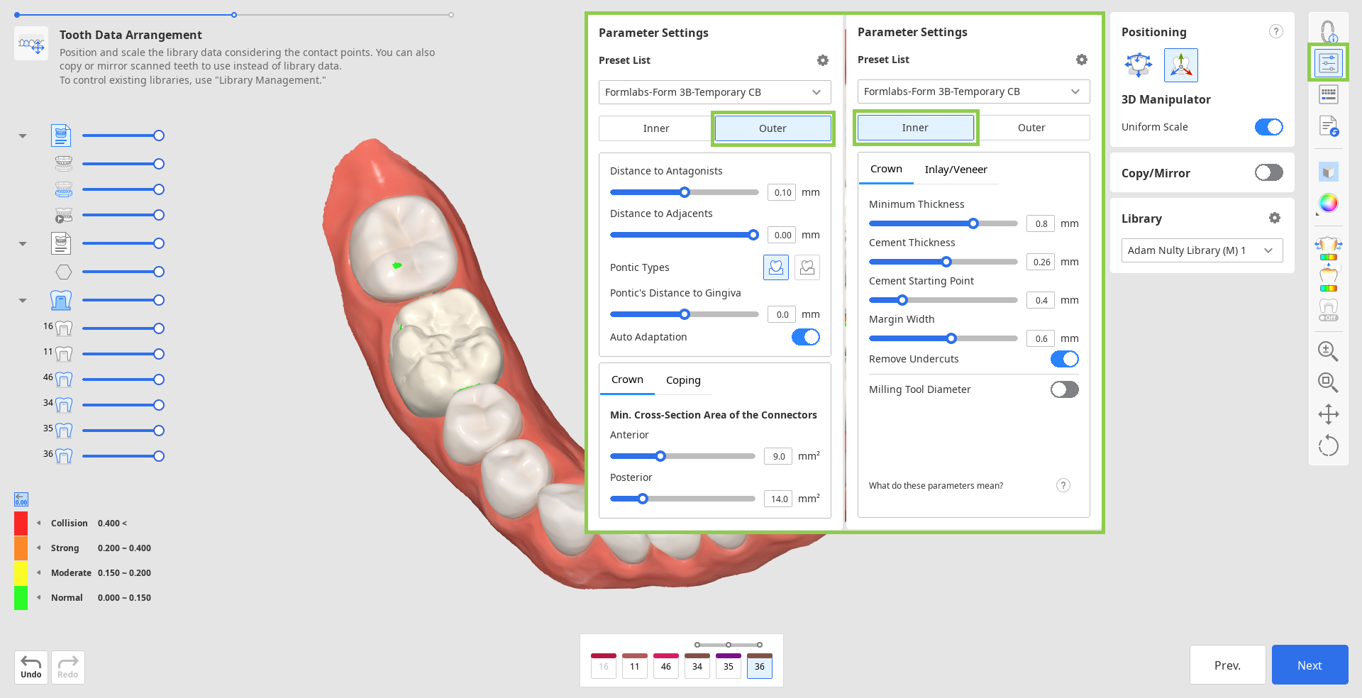 prep_tooth_data_arrangement__10