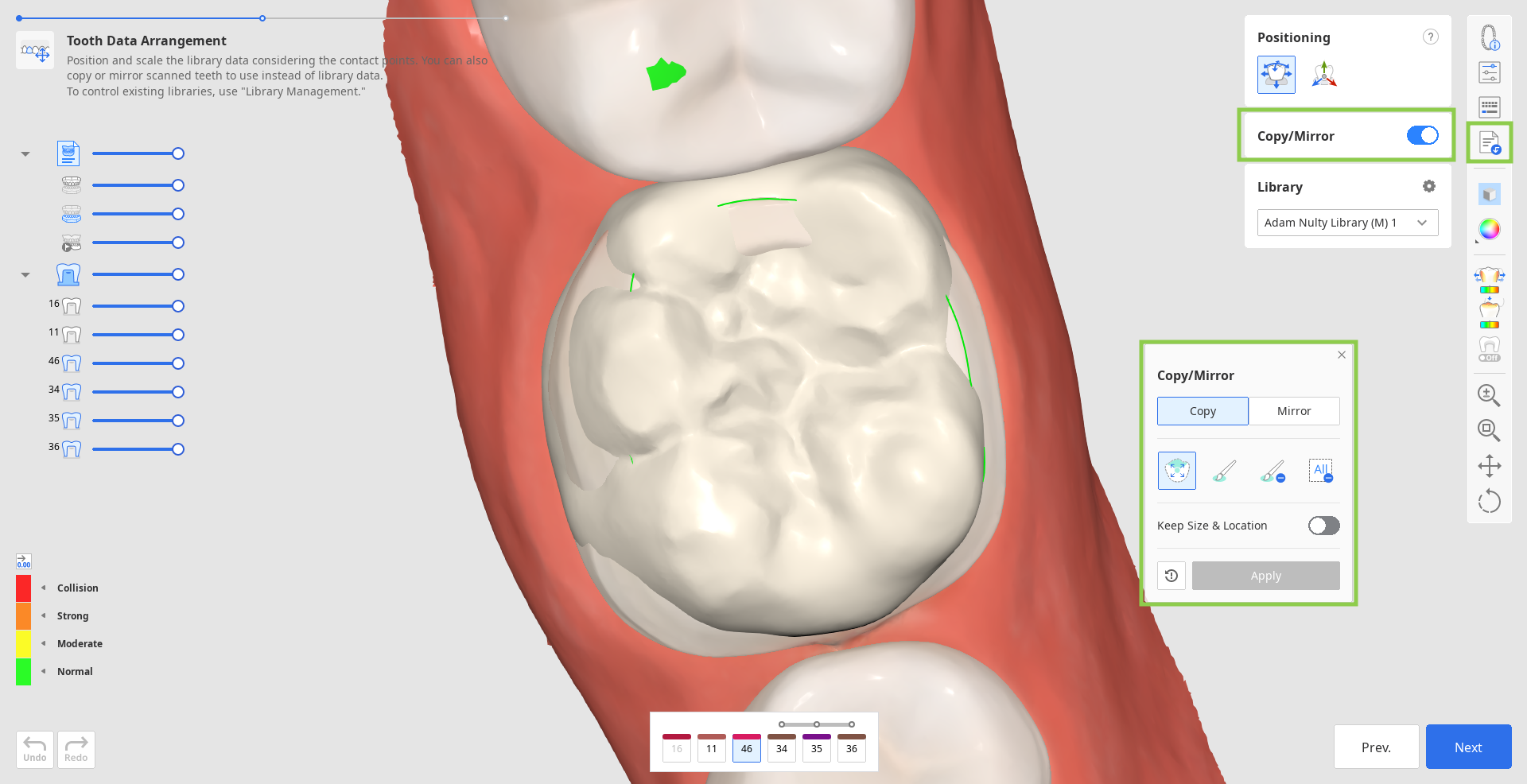 prep_tooth_data_arrangement__2
