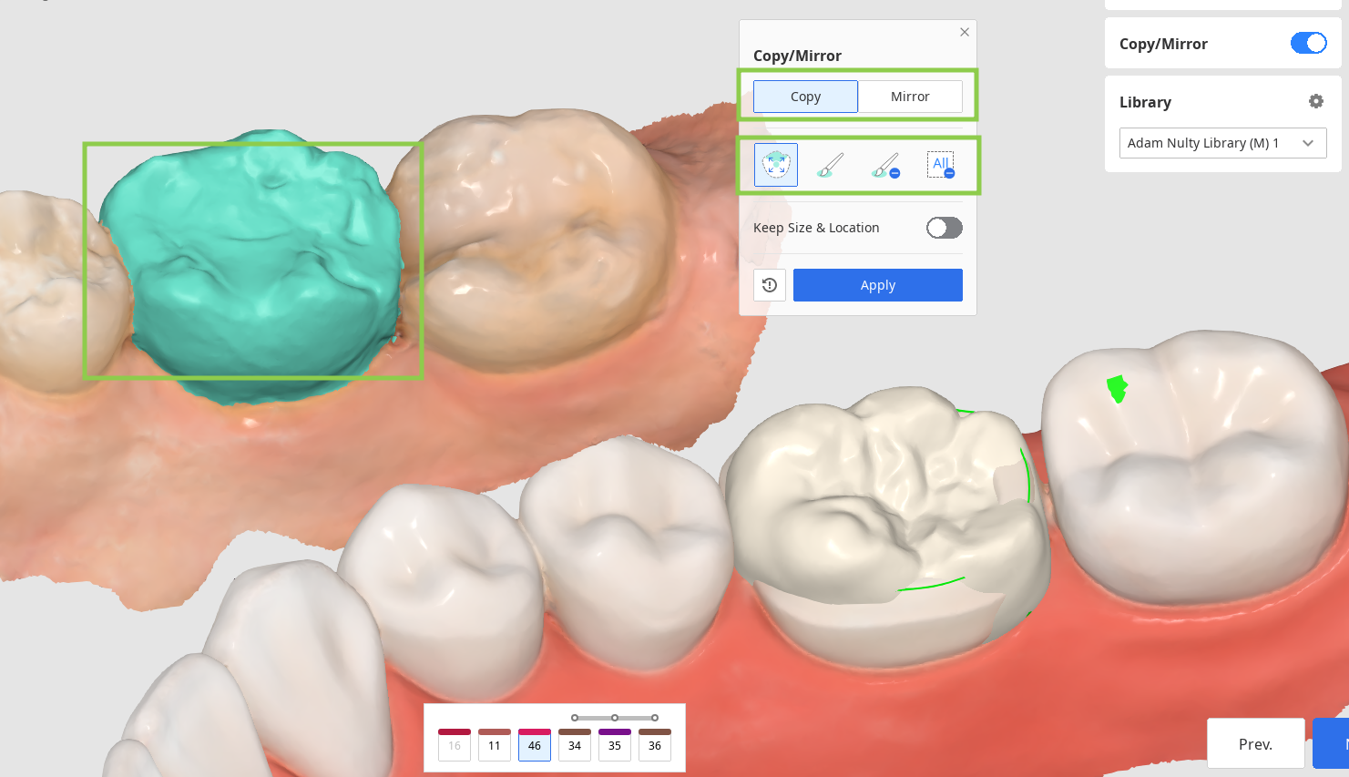 prep_tooth_data_arrangement__4