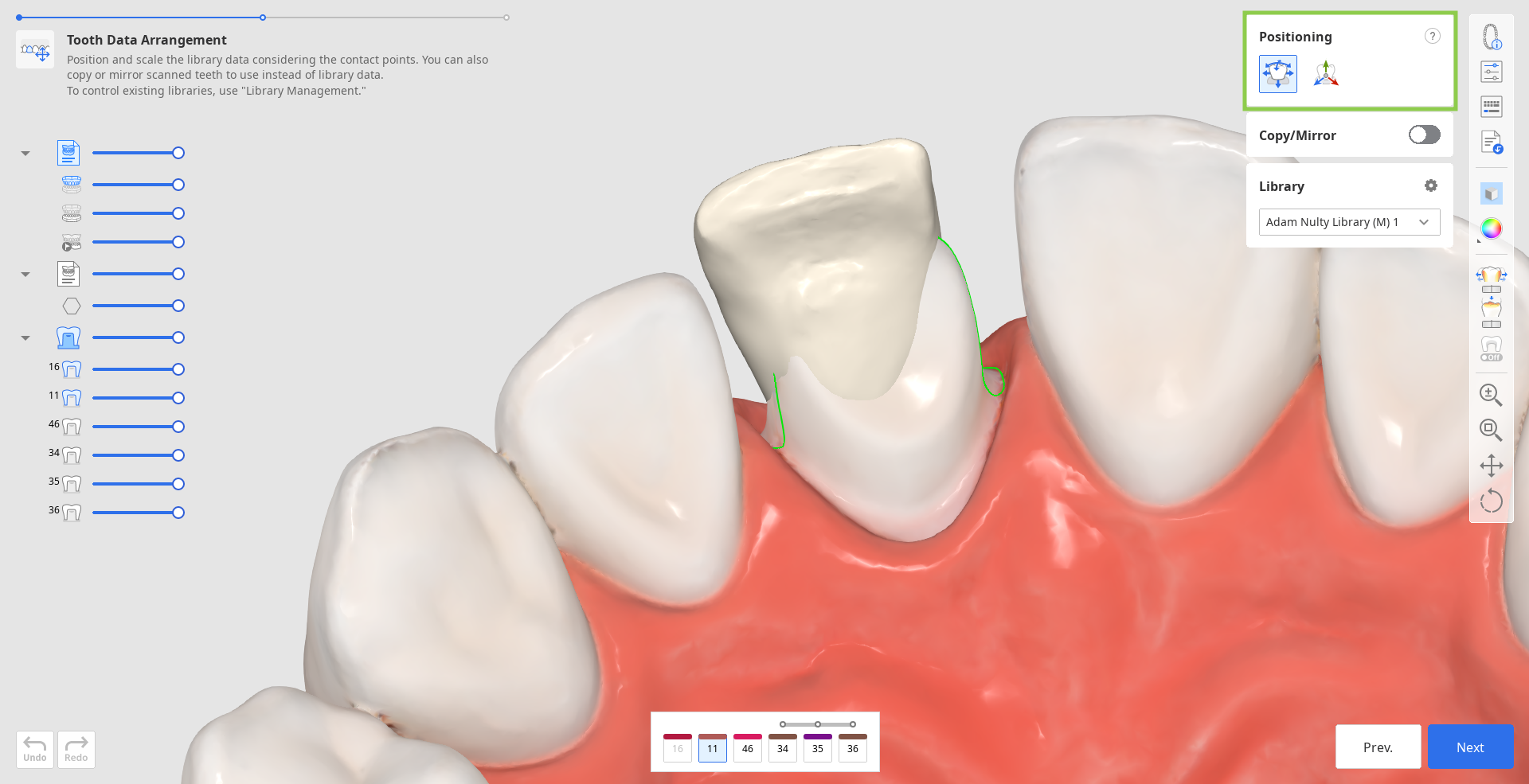 prep_tooth_data_arrangement__6