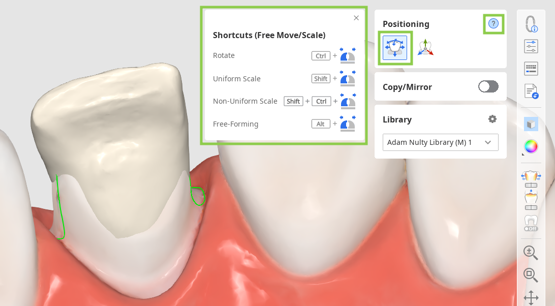prep_tooth_data_arrangement__7