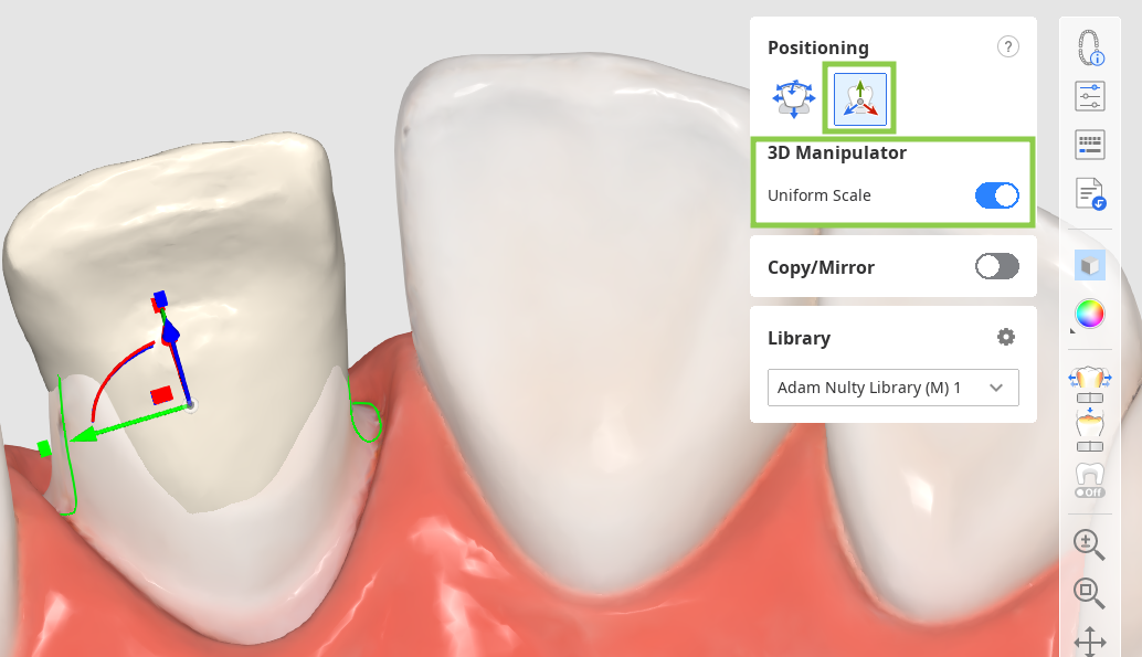 prep_tooth_data_arrangement__8