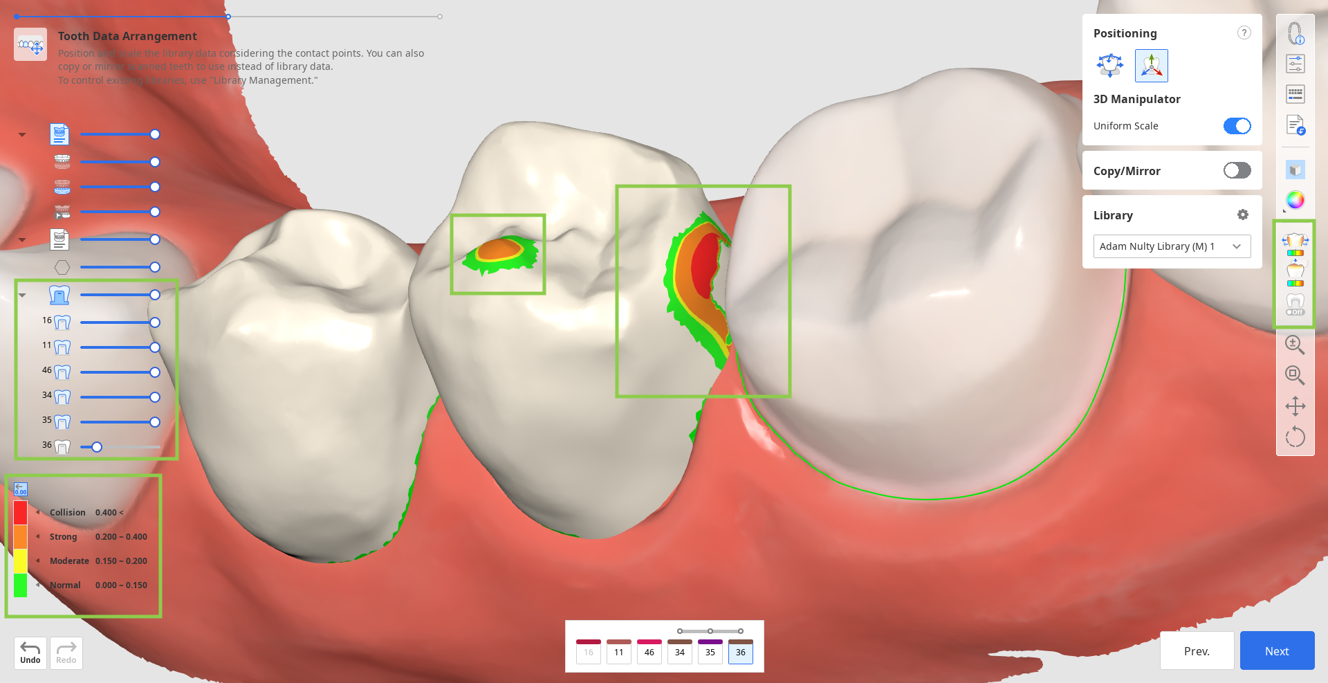 prep_tooth_data_arrangement__9