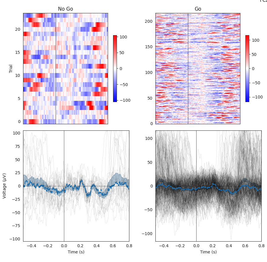 Image: EEG analysis graphs.